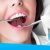 [Imagen:¡Paga $25 en lugar de $225 por 3 Rellenos de Resina o 4 Sellantes + Consulta y Diagnóstico Bucodental con Cámara Intraoral + Limpieza con Ultrasonido + Radiografía + Aplicación de Flúor + Evaluación de Cordales!]