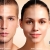 [Imagen:¡Paga Q99 en lugar de Q1,050 por Facial Láser Antiacné, Antiaging o Antimanchas + 1 Mascarilla Personalizada + Examen Diagnóstico Profesional!]