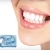 [Imagen:¡Paga Q260 en vez de Q1,500 por un examen diagnóstico + presupuesto + radiografías + limpieza + eliminación de sarro + aplicación de flúor + rellenos estéticos de resina en Excel Dental!]