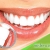 [Imagen:¡Paga Q85 en lugar de Q400 por una limpieza bucal completa que incluye: pulido y desmanchado de dientes + eliminación de sarro + una radiografía intraoral + examen bucal por video imágenes + aplicación de flúor + informe dental en Asistencia Dental!]