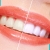 [Imagen:¡Paga $50 en Lugar de $195 por Blanqueamiento Dental Químico con Luz LED + Limpieza Profunda con Ultrasonido (Destartraje) + Consulta Odontológica!]