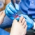 [Imagen:¡Paga $35 en lugar de $325 por 1 Sesión de Láser Dermatológico para Eliminar Hongos en hasta 5 Uñas!]