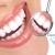 [Imagen:¡Paga $20 en lugar de $85 por limpieza con ultrasonido + diagnóstico con cámara intraoral + aplicación de flúor + relleno de resina blanca o sellante en Dental Clinic! ¡Además, recibe un 15% de descuento en cualquier tratamiento adicional!]