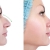 [Imagen:¡Paga Q1,899 en lugar de Q10,500 por Rinomodelación o Rejuvenecimiento Facial con Hilos Tensores + Aplicación de Ácido Hialurónico o Plasma Gel + 1 Limpieza Facial Profunda + Microdermoabrasión + Evaluación!]