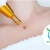 [Imagen:¡Paga Q149 en Lugar de Q900 por Cauterización Láser de hasta 20 Cabezas de Vena o 4 Lunares o 4 Verrugas (de hasta 5mm) + Evaluación Médica!]