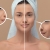 [Imagen:¡Paga Q99 en Lugar de Q400 por Facial Antiacné y Antimanchas que Incluye: 1 Microdermoabrasión + 1 Radiofrecuencia 1 Limpieza Facial + 1 Exfoliación + 1 Vapor de Ozono + 1 Extracción de Puntos Negros + 1 Velo de Colágeno y Más!]