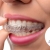 [Imagen:¡Paga $90 en Lugar de $385 por Colocación de Brackets Metálicos + Evaluación y Diagnóstico Clínico + Fotografías y Modelo de Estudio + 3 Consultas de Control!]