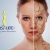[Imagen:¡Paga Q275 en lugar de Q1425 por 4 sesiones de peeling químico facial que incluye: 4 aplicaciones de ácido glicólico + 4 altafrecuencias + 4 hidrataciones y protección solar + 4 mascarillas anti-envejecimiento o anti-acné en Crisalide!]