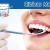 [Imagen:¡Paga $29 en lugar de $165 por Diagnostico Buco-Dental + Limpieza con Ultrasonido + Aplicación de Flúor + 2 rellenos estéticos de resina blanca o 4 sellantes de fosas y fisuras en Clínicas Matasol! Recibe 30% de descuento en tratamientos adicionales]