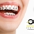 [Imagen:¡Paga $90 en Lugar de $450 por Colocación de Brackets Metálicos + Evaluación y Diagnóstico Clínico + Fotografías y Modelo de Estudio + 3 Consultas de Control!]