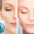 [Imagen:¡Paga $29 en lugar de $167 por facial anti-edad que incluye: Limpieza Profunda + Mascarilla Hidratante a base de calor + Presoterapia Esférica + Lifting Facial + Spa de Manos en Marshelly Centro de Estética y Spa!]