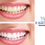 [Imagen:¡Paga $85 en lugar de $325 por 1 Sesión de Blanqueamiento Dental con Sistema Zoom + Consulta Odontológica + Diagnóstico con Cámara Intraoral + Limpieza con Ultrasonido en Western Dental!]