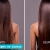 [Imagen:¡El Alisado que Tu Cabello Necesita! ¡Paga Q399 en Lugar de Q1,400 por Alisado de Keratina LED Inteligente y Personalizado + Kit de Shampoo y Acondicionador + Reactivación!]