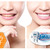 [Imagen:¡Paga $75 en lugar de $350 por Blanqueamiento Dental con Luz LED + Limpieza Dental con Ultrasonido + Aplicación de Desensibilizante + Aplicación de Flúor en Clínica Dental Smiling!]