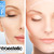 [Imagen:¡Paga Q275 en vez de Q1825 por Exclusivo SÚPER Paquete Facial de 15 Tratamientos que incluye: 3 Sesiones de Microdermoabrasión+ 3 Sesiones de Peeling con Ácido Mandélico+ 3 Infusiones Antioxidantes + 3 Oxigenaciones + 3 Hidrataciones en Centroestic!]