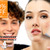 [Imagen:¡Dile “adiós” al acné! ¡Paga $99 en lugar de $950 por 4 sesiones de laser anti-acné y 4 faciales en Clínica Venolaser!]