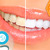 [Imagen:¡Paga $35 en lugar de $120 por Blanqueamiento Dental de 2 Cubetas + Limpieza con Ultrasonido + Pulido con Bicarbonato + Diagnóstico con Cámara Intraoral en Clínicas Médicas Romano!]
