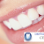 [Imagen:¡Paga $73 en vez de $250 por dos sesiones de blanqueamiento dental, limpieza y un diagnóstico clínico con cámara intraoral en Dental Shine Center!]
