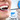 [Imagen:¡Paga Q349 en lugar de Q1,225 por Extracción de 1 Cordal + 1 Radiografía + Profilaxis Dental + Consulta y Examen Diagnóstico + Consulta Post-Operatoria y Más en In Dent!]
