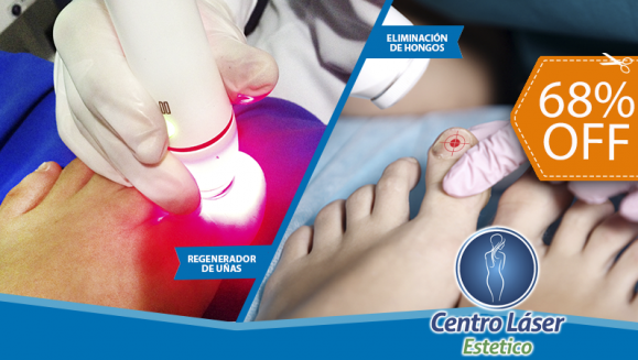 [Image: ¡Paga $35 en lugar de $110 por 1 Sesión Láser para Eliminar Hongos en 2 Uñas!m]