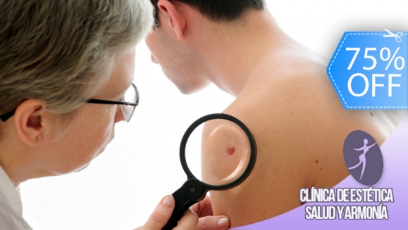 [Image: ¡Paga Q69 en lugar de Q280 por Cauterización Láser de Mezquinos, Verrugas, Lunares o Cabezas de Vena!m]