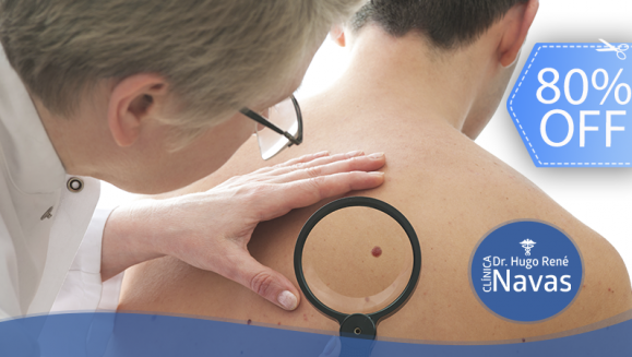 [Image: ¡Paga Q99 en lugar de Q500 por Sesión Láser Co2 para Eliminar Hasta 10 Cabecitas de Venas y Lunares!m]