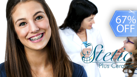 [Image: ¡Paga Q599 en lugar de Q1,800 por Colocación de Mini-Brackets (Superiores e Inferiores) + Evaluación y Diagnóstico Clínico + Profilaxis Dental + Fotografías y Modelo de Estudio!m]