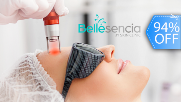 [Image: ¡Paga Q135 en lugar de Q2,100 por Facial Antiacné, Despigmentante o Antiaging que Incluye: Limpieza Profunda + Extracción de Impurezas + 2 Sesiones Láser o 2 Peelings + 2 Mascarillas + 2 Hidrataciones + Protección Solar!m]