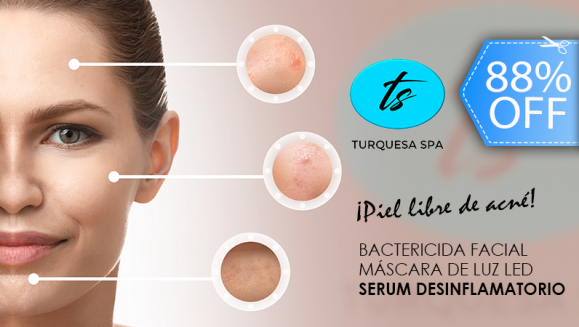[Image: ¡Paga Q149 en vez de Q1,200 por 2 Sesiones de Facial Antiacné con: Limpieza Profunda + Extracción de Puntos Negros + Bactericida + Vapor + Exfoliación + Mascarilla Personalizada + IPL + Luz LED + Ultrasonido + Serum Desinflamatorio y Más!m]