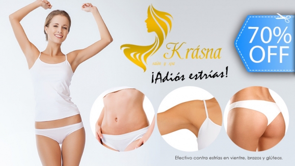 [Image: ¡Paga Q149 en lugar de Q500 por Tratamiento para Estrías en Área a Elección entre Vientre, Glúteos o Brazos que Incluye: 3 Peelings + 3 Láser + 3 Microdermoabrasiones + 3 Radiofrecuencias + 4 Mascarillas de Alto Impacto!m]