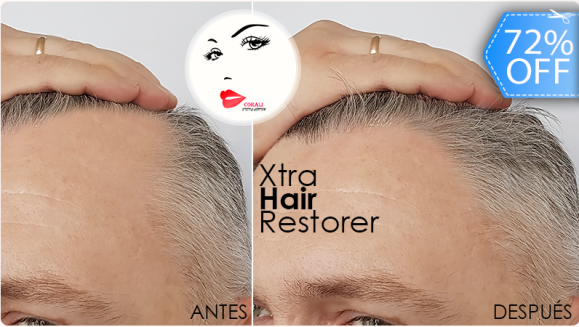 [Image: ¡Paga Q199 en lugar de Q700 por Tratamiento Anticalvicie que Incluye: 2 Sesiones de Mesoterapia Xtra Hair Restorer + 2 Altafrecuencias + 2 Luces de Fotón + 2 Estimuladores de Ozono!m]