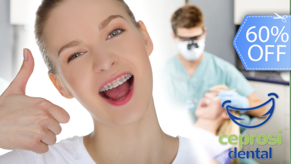 [Image: ¡Paga Q599 en Lugar de Q1,500 por Colocación de Mini-Brackets Metálicos (Inferior y Superior) + Set de Radiografías Intraorales + Modelos de Estudio + Limpieza Dental + Kit de Limpieza!m]