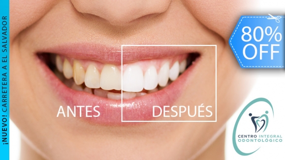 [Image: ¡Paga Q450 en lugar de Q2,200 por Blanqueamiento Dental con Luz LED + Limpieza con Ultrasonido + Pulido con Profijet + Kit de Mantenimiento en Casa + Evaluación con Cámara Intraoral!m]
