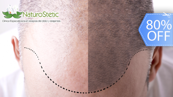 [Image: ¡Recupera tu Hermosa Cabellera! ¡Paga Q299 en lugar de Q1,500 por 1 Sesión de Plasma Rico en Plaquetas + Terapia de Luz LED para Alopecia (Calvicie)!m]
