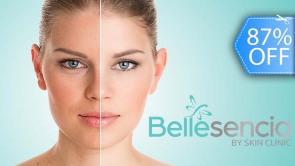 [Image: ¡Paga Q199 en lugar de Q1,500 por 2 Sesiones de Facial Antiaging que Incluyen: 2 Aplicaciones de Láser IPL + 2 Limpiezas Personalizadas con Producto Orgánico + 2 Mascarilla de Colágeno + 2 Mascarillas Calmantes!m]