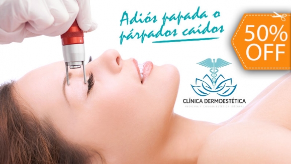 Image of 2 Sesiones de Derma-Age para Eliminar Párpados Caídos o Papada