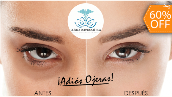 [Image: ¡Paga $10 en Lugar de $25 por 1 Sesión de Tratamiento Antiojeras que Incluye: Microdermoabrasión + Peeling + Consulta Médica + Evaluación del Cutis con Tecnología Skyn Analyzer!m]