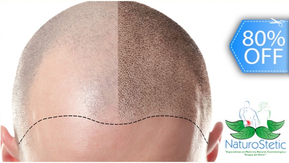 [Image: ¡Recupera tu Hermosa Cabellera! ¡Paga Q299 en lugar de Q1,500 por 2 Sesiones de Plasma Rico en Plaquetas + Terapia de Luz LED para Alopecia (Calvicie)!m]