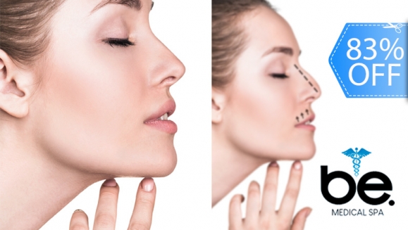 [Image: ¡Paga Q1,899 en Lugar de Q11,000 por Rinomodelación o Rejuvenecimiento Facial con Hilos Tensores + PRP + Aplicación de Ácido Hialurónico o Plasma Gel + 1 Limpieza Facial Profunda + Microdermoabrasión + Evaluación!m]