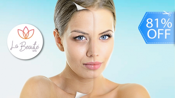 [Image: ¡Paga Q169 en Lugar de Q867 por 2 Sesiones de Rejuvenecimiento Facial que Incluye: 2 Láser IPL + 2 Limpiezas Faciales + 2 Aplicaciones de Serum de Retinol + 2 Aplicaciones de Vitamina C + 2 Aplicaciones de Filtro Solar!m]