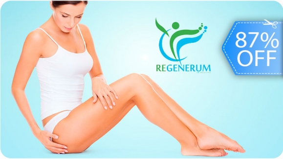 [Image: ¡Paga Q199 en Lugar de Q1,500 por 1 Sesión de Láser o de Espuma Esclerosante para Eliminar Varices o Venas Tipo Arañitas + Evaluación Médica!m]