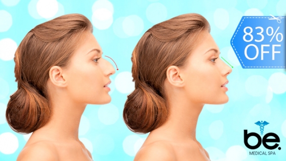 [Image: ¡Paga Q1,899 en Lugar de Q11,000 por Rinomodelación o Rejuvenecimiento Facial con Acido Hialurónico (1 Jeringa) + PRP + Limpieza Facial Profunda + Microdermoabrasión + 1 Sesión de Lipólisis QUEMA GRASA CORPORAL!m]