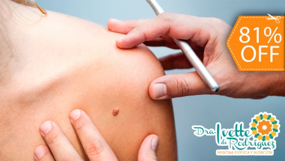 [Image: ¡Paga $18 en lugar de $95 Electo-Cauterización de hasta 20 Verrugas!m]