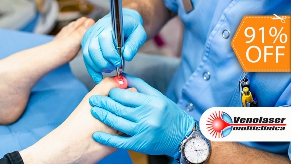 [Image: ¡Paga $30 en Lugar de $325 por 1 Sesión Láser para Eliminar Hongos en 5 Uñas!m]