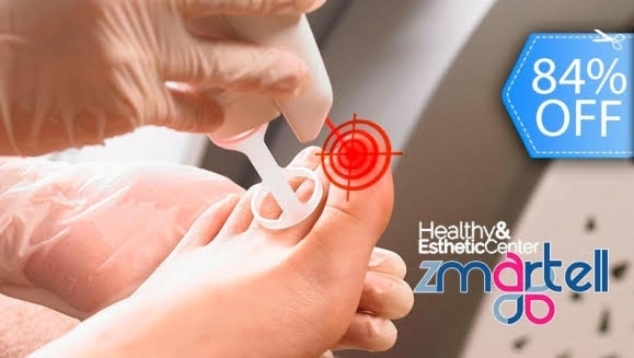 [Image: ¡Paga Q99 en Lugar de Q600 por 1 Sesión Láser para Eliminar Hongos en hasta 10 Uñas de Manos o Pies + Diagnóstico Profesional + Aplicación de Crema Antimicótica!m]