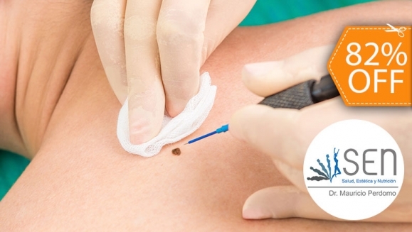 [Image: ¡Paga $18 en Lugar de $100 por Electrocauterización de hasta 20 Verrugas!m]