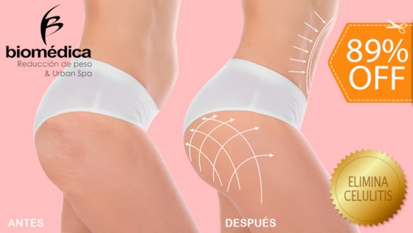 [Image: ¡Paga $22 en vez de $200 por Tratamiento "GLUPACK 4 en 1": Levanta los Glúteos, Reduce Las Piernas, Moldea Las Caderas y Elimina La Celulitis con: 5 Nanofrecuencias Brasileñas + 3 Maderoterapias + 3 Lumicell y Más + 2 Limpiezas Faciales con THE CLAY!m]