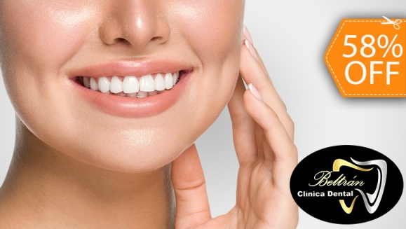 [Image: ¡Paga $50 en Lugar de $120 por Blanqueamiento Dental Químico con Luz LED + Limpieza Profunda con Ultrasonido (Detartraje) + Consulta Odontológica!m]