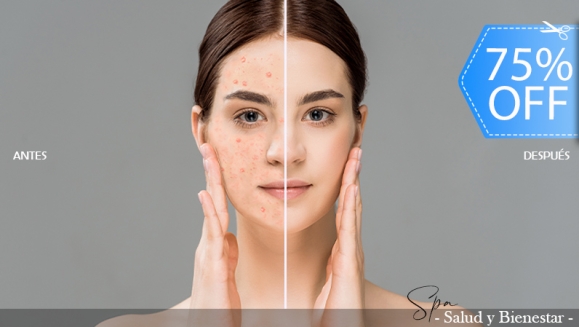 [Image: ¡Paga Q99 en Lugar de Q400 por Facial Antiacné que Incluye: Peeling + Mascara LED + Altafrecuencia + Ultrasonido + Vapor y Ozono para Manchas + Mascarilla Especializada + Exfoliación + Vitamina C! Dejando a la vista la piel renovada que deseas!m]