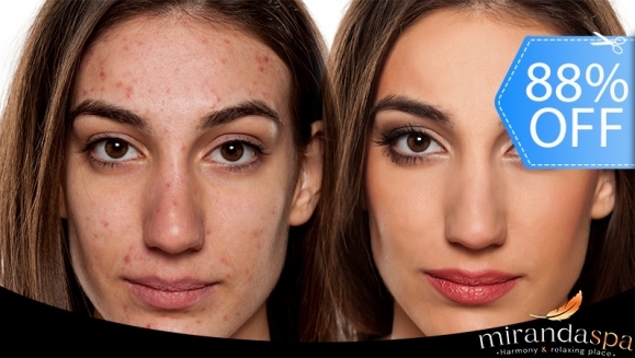 [Image: ¡Paga Q99 en Lugar de Q800 por Facial Antiacné con Limpieza Profunda + Extracción + Peeling Ultrasónico + Microdermoabrasión + Tónico Seboregulador + Terapia LED + Mascarilla Personalizada + Cauterización de Barros + Aplicación de Protector Solar!m]